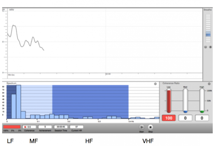 HRV