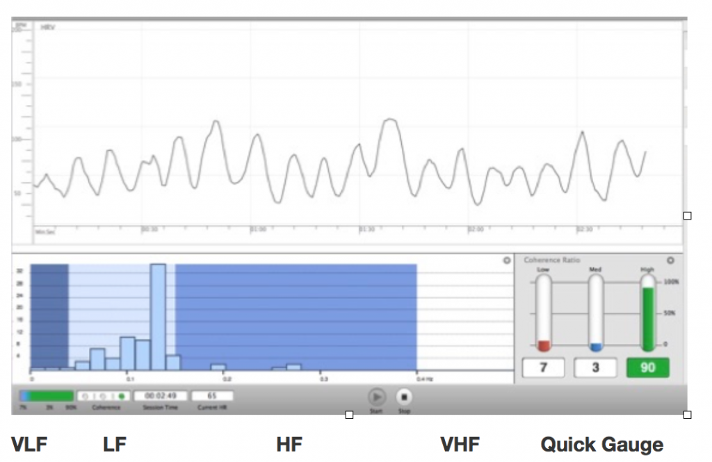 Anatomy of an HRV Graph